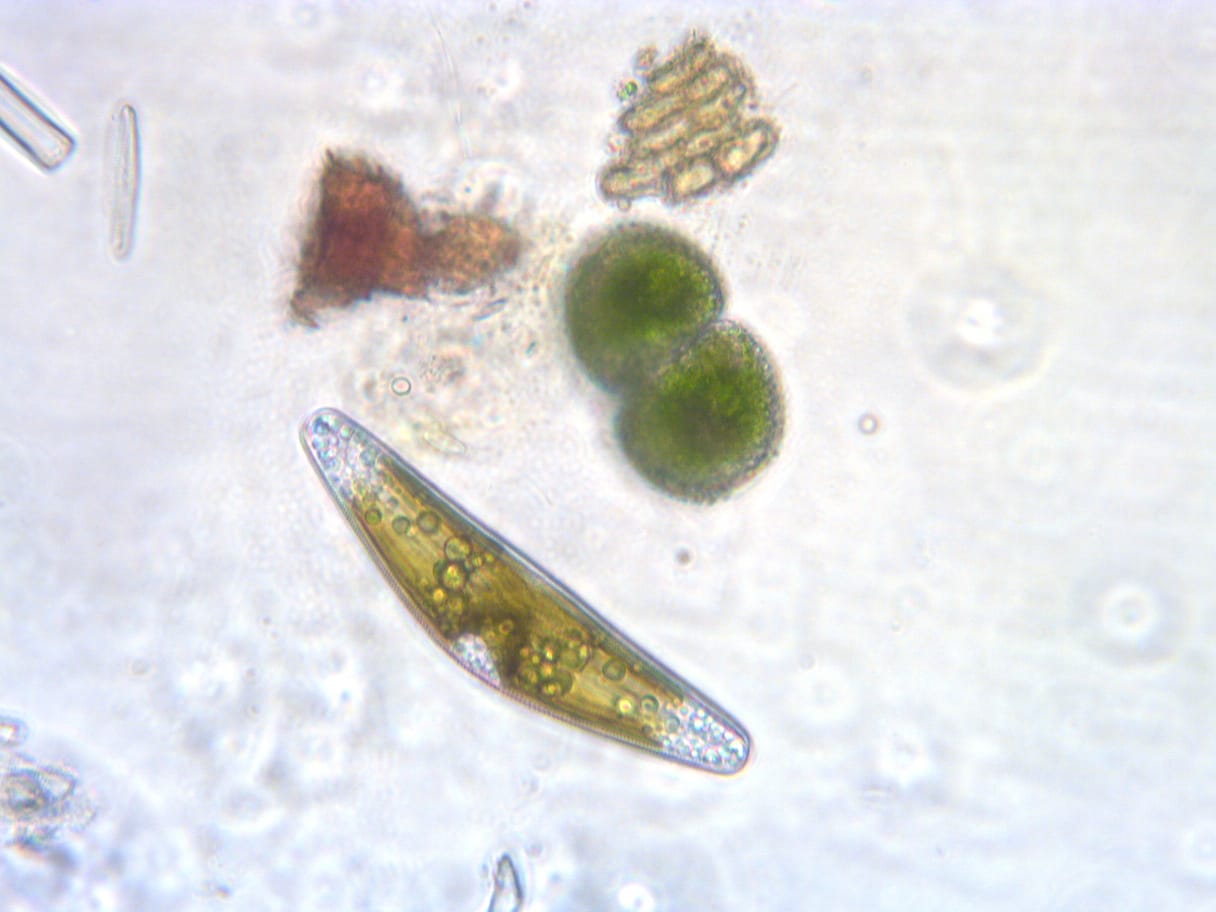 Photo of plankton collected at Moss and Water.